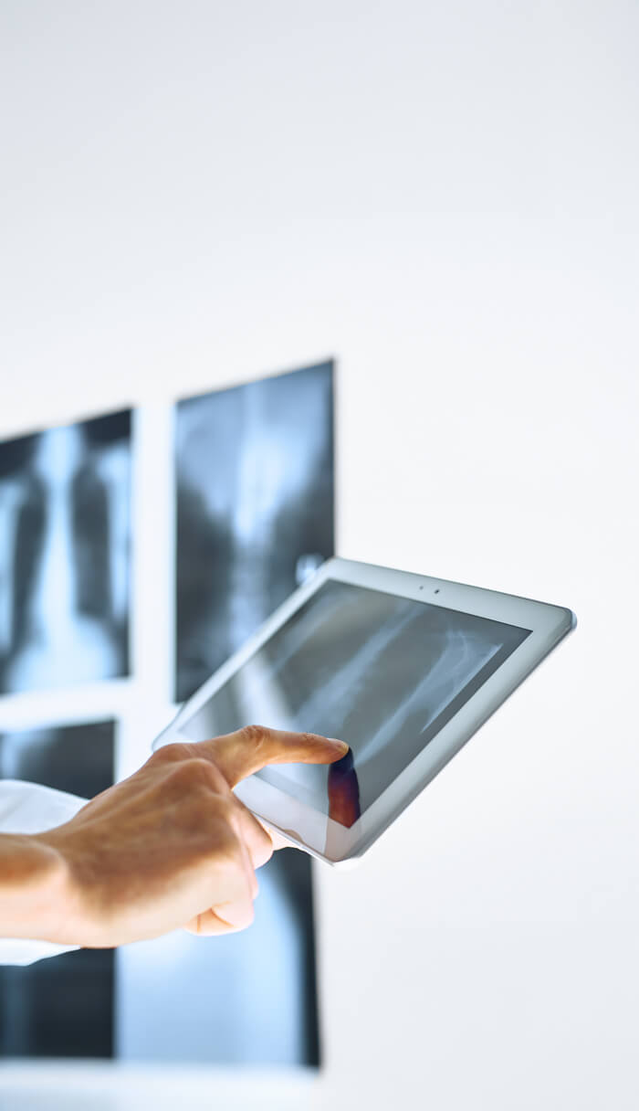 X-ray RX Impact sur le toit C