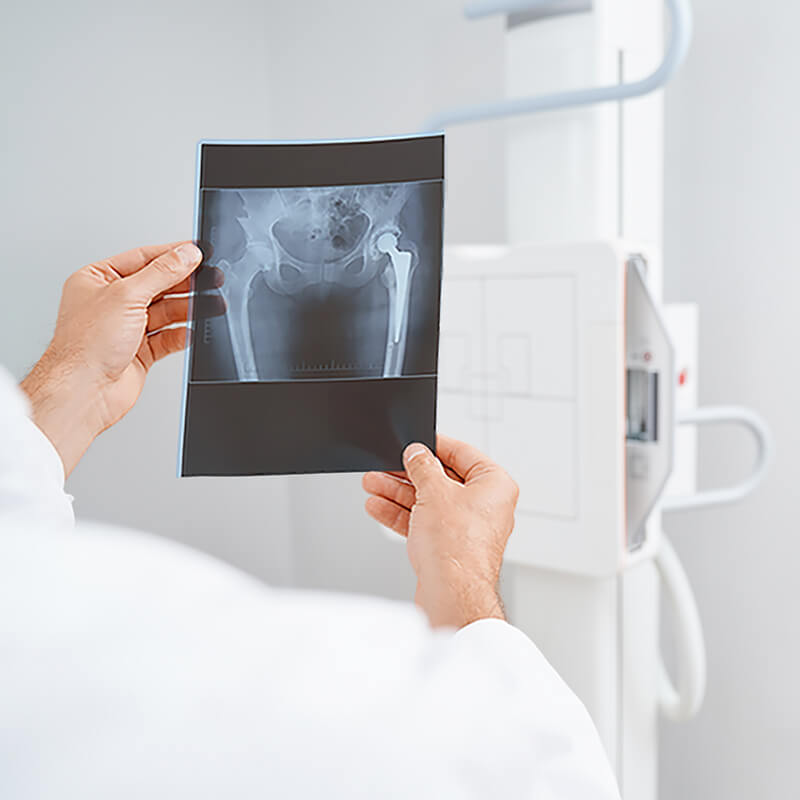 instalaciones_diagnostico de imagen-hospital-recoletas-salud-marbella