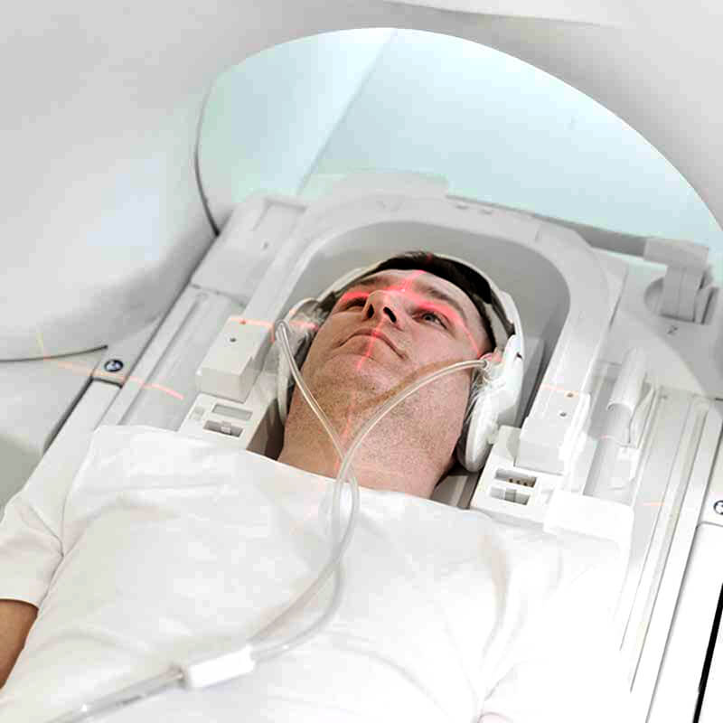 neurochirurgie-hôpital-recoletas-santé-marbella