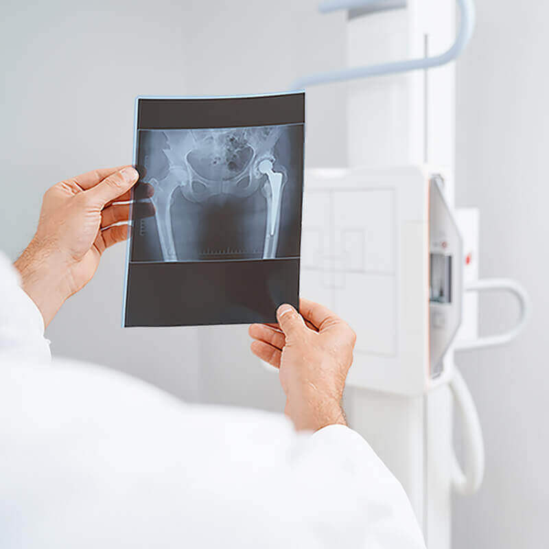 instalaciones_diagnosticodeimagen-hospital-recoletas-salud-marbella